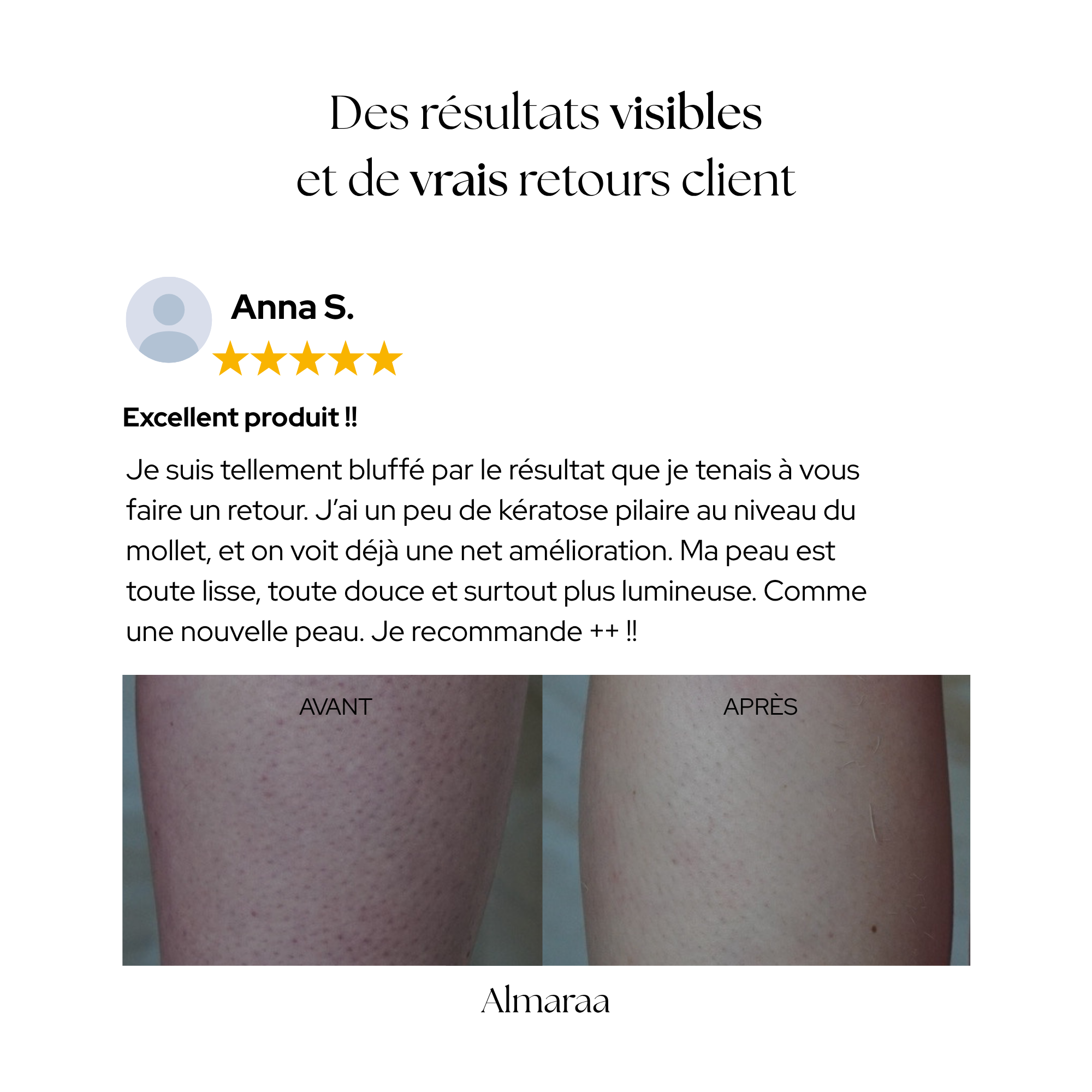 Gants en soie - Visage & Corps